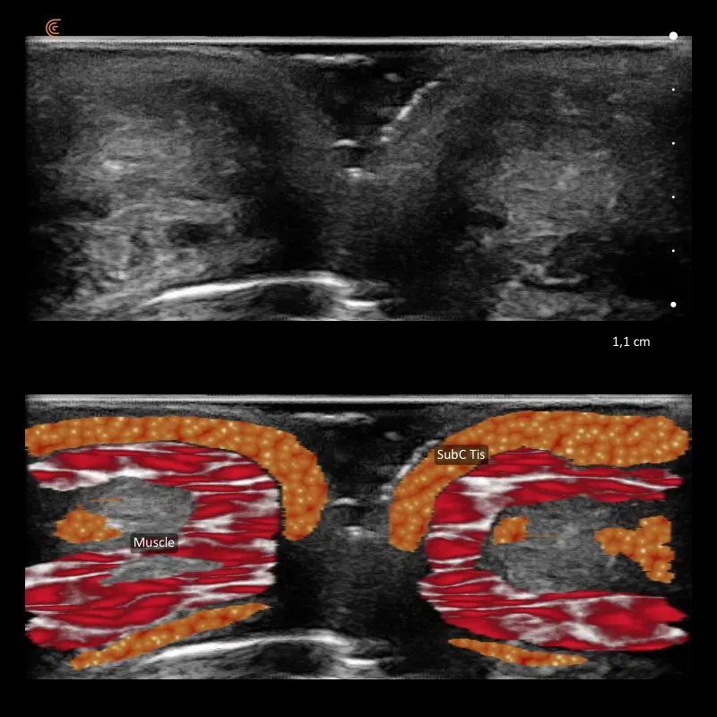 Obraz ultrasonograficzny tkanek twarzy oraz schemat ich anatomii